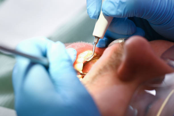 Best Emergency Cosmetic Dentistry in Golden Gate, FL