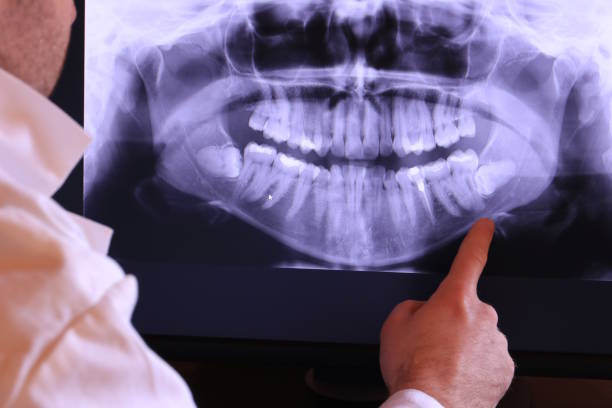 Best Emergency Dental Care for Abscessed Tooth in Golden Gate, FL