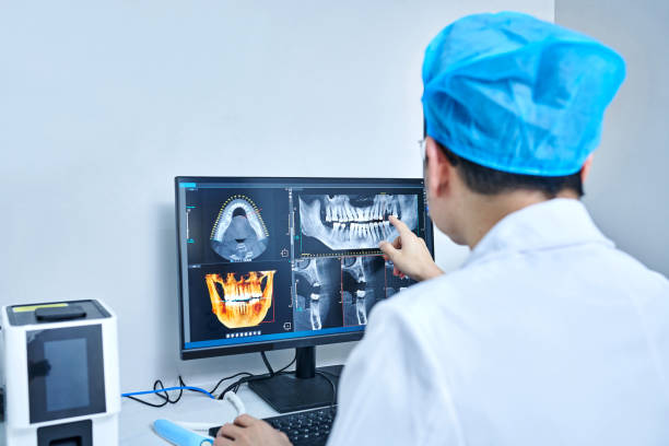 Best Emergency Root Canal Treatment in Golden Gate, FL